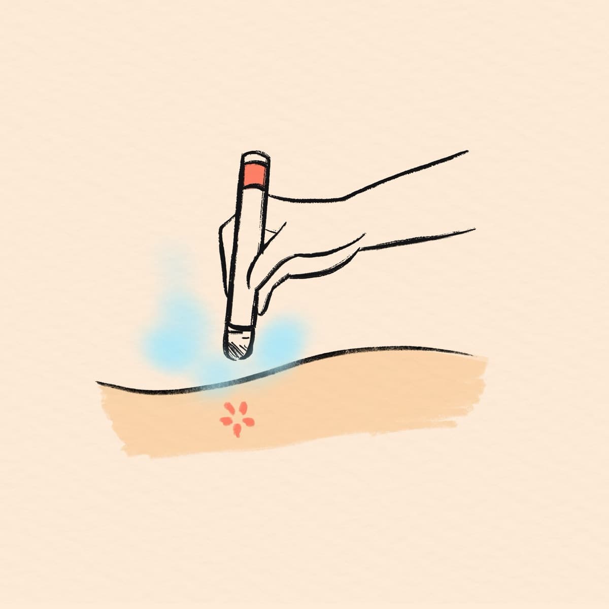 Moxibustion at Chenming TCM Clinic, Bangkok Chinatown near Hua Lamphong MRT